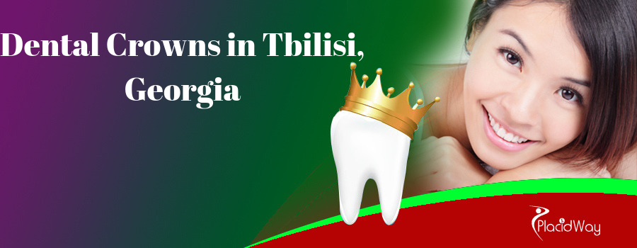 Dental Crowns in Tbilisi, Georgia